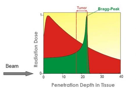 Dose distribution 