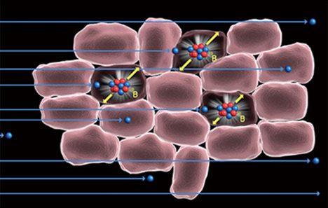 BNCT now clinically convenient with SUMITOMO's cyclotron